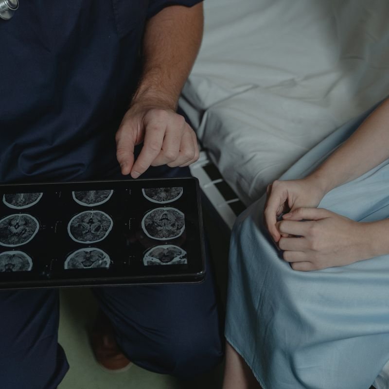 Cirugía de Epilepsia