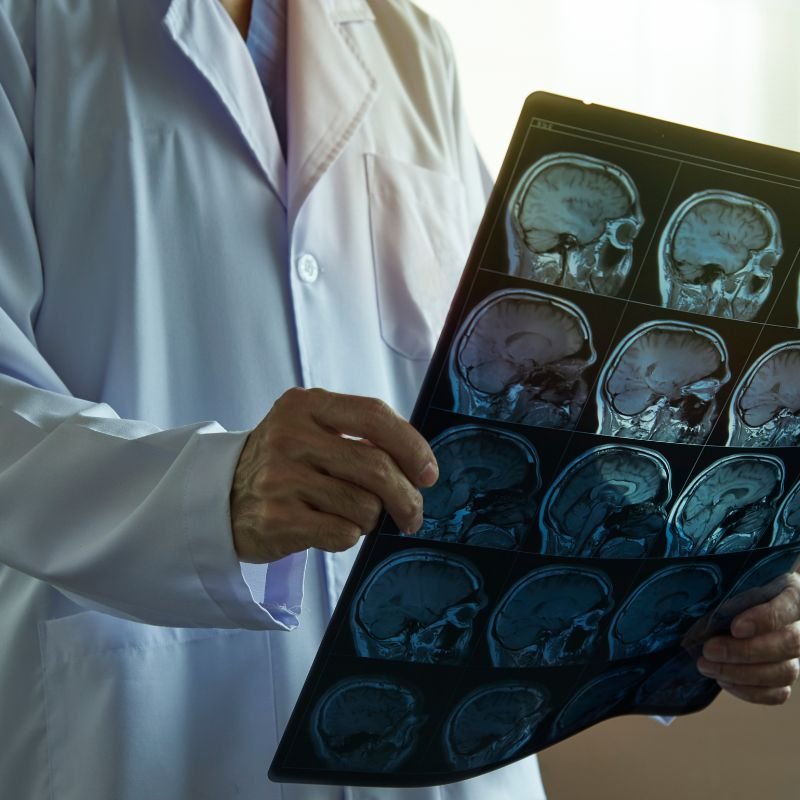 Neuroendoscopía